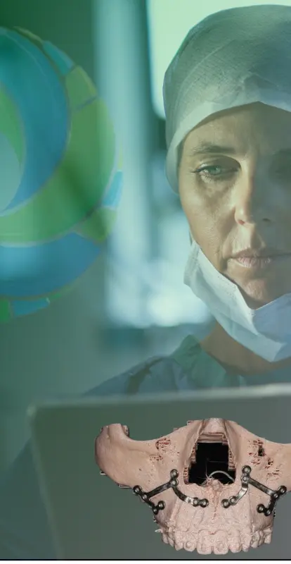 Innovación en Cirugía Ortognática: Guías de Corte Personalizadas